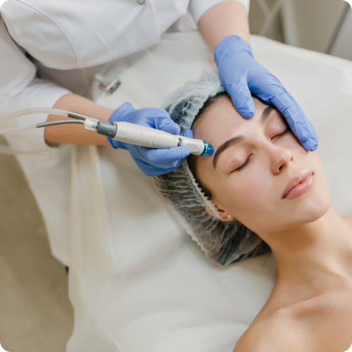 Microdermabrasion Treatments by Assure