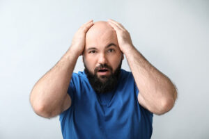 Hair Transplant Treatment