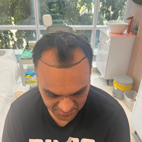 Ankur Vasu — Before