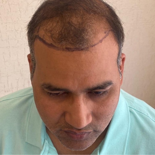 Gajendra Samota — Before