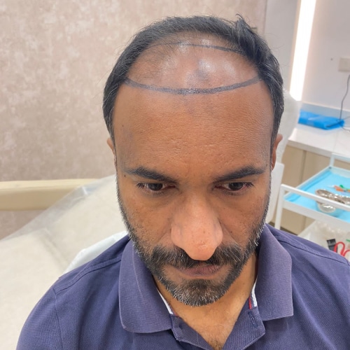 Sam (Dubai) — Before