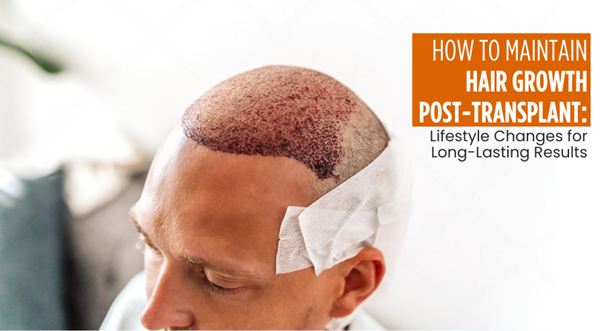 How to Maintain Hair Growth Post-Transplant: Lifestyle Changes for Long-Lasting Results