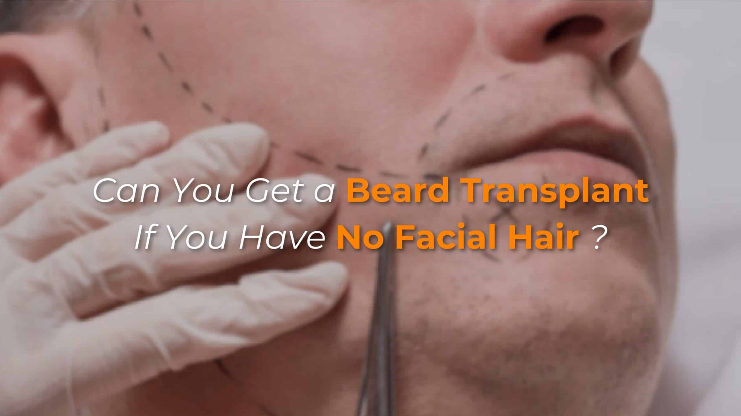 Can You Get a Beard Transplant If You Have No Facial Hair?