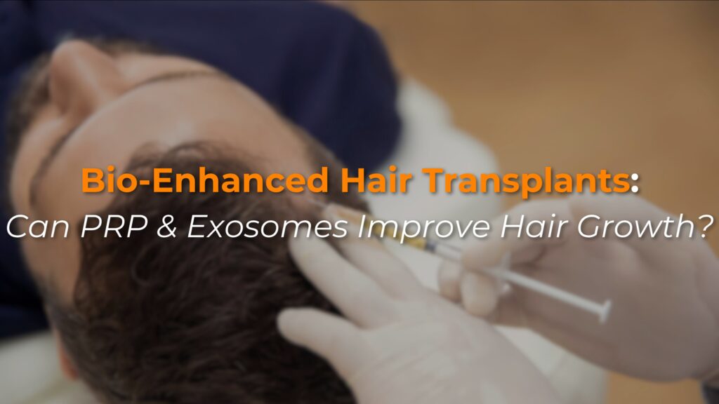 Bio-Enhanced Hair Transplants: Can PRP & Exosomes Improve Hair Growth?