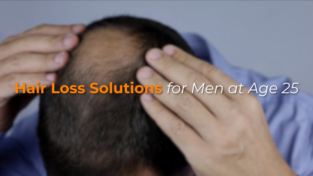 Hair Loss Solutions for Men at Age 25