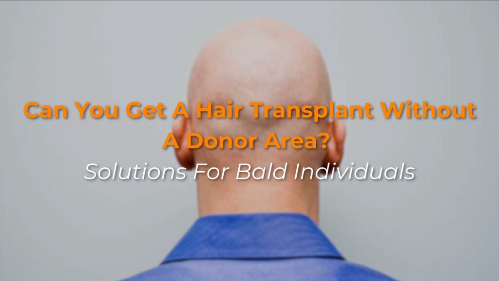Can You Get a Hair Transplant Without a Donor Area? Solutions for bald individuls