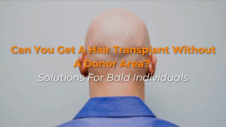 Can You Get a Hair Transplant Without a Donor Area? Solutions for bald individuls