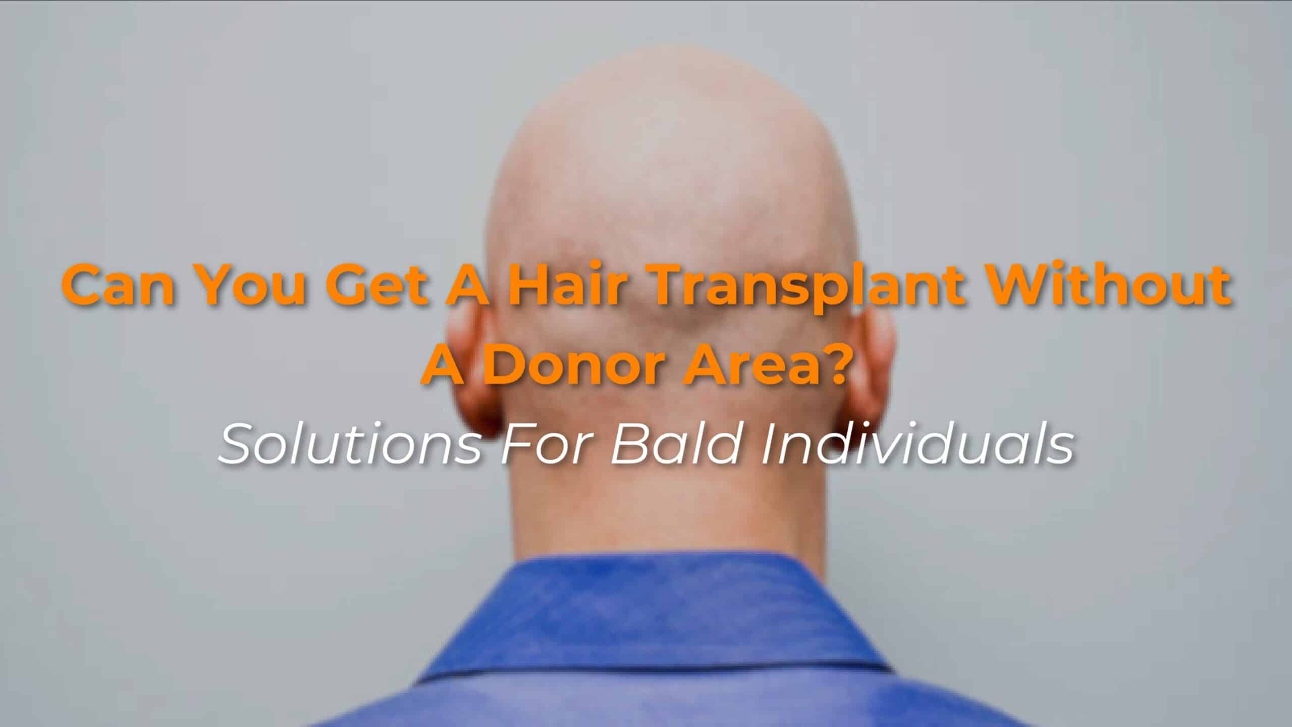 Can You Get a Hair Transplant Without a Donor Area? Solutions for bald individuls