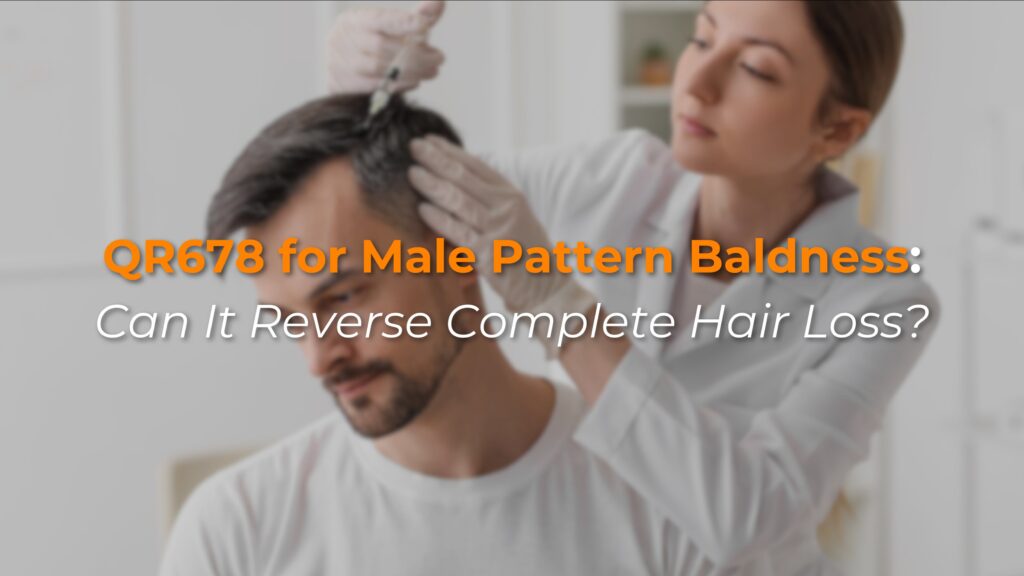 QR678 for Male Pattern Baldness: Can It Reverse Complete Hair Loss?