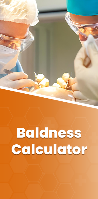 Baldness Calculator | Assure Clinic
