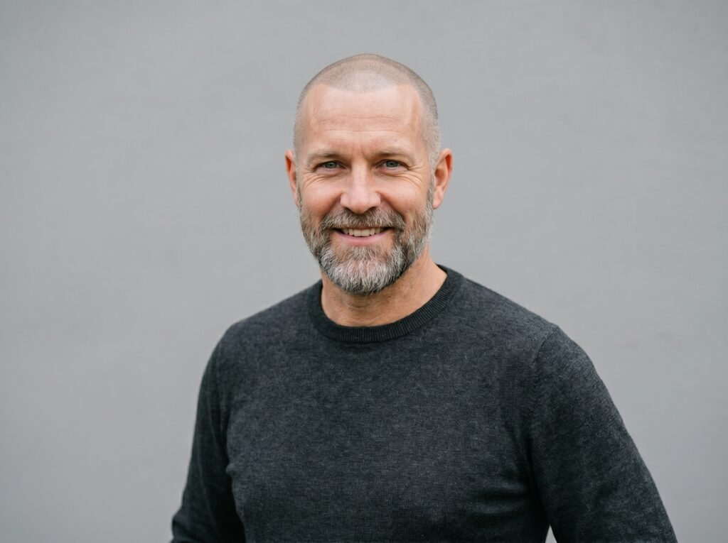 Shaved head look for men with extensive hairline recession