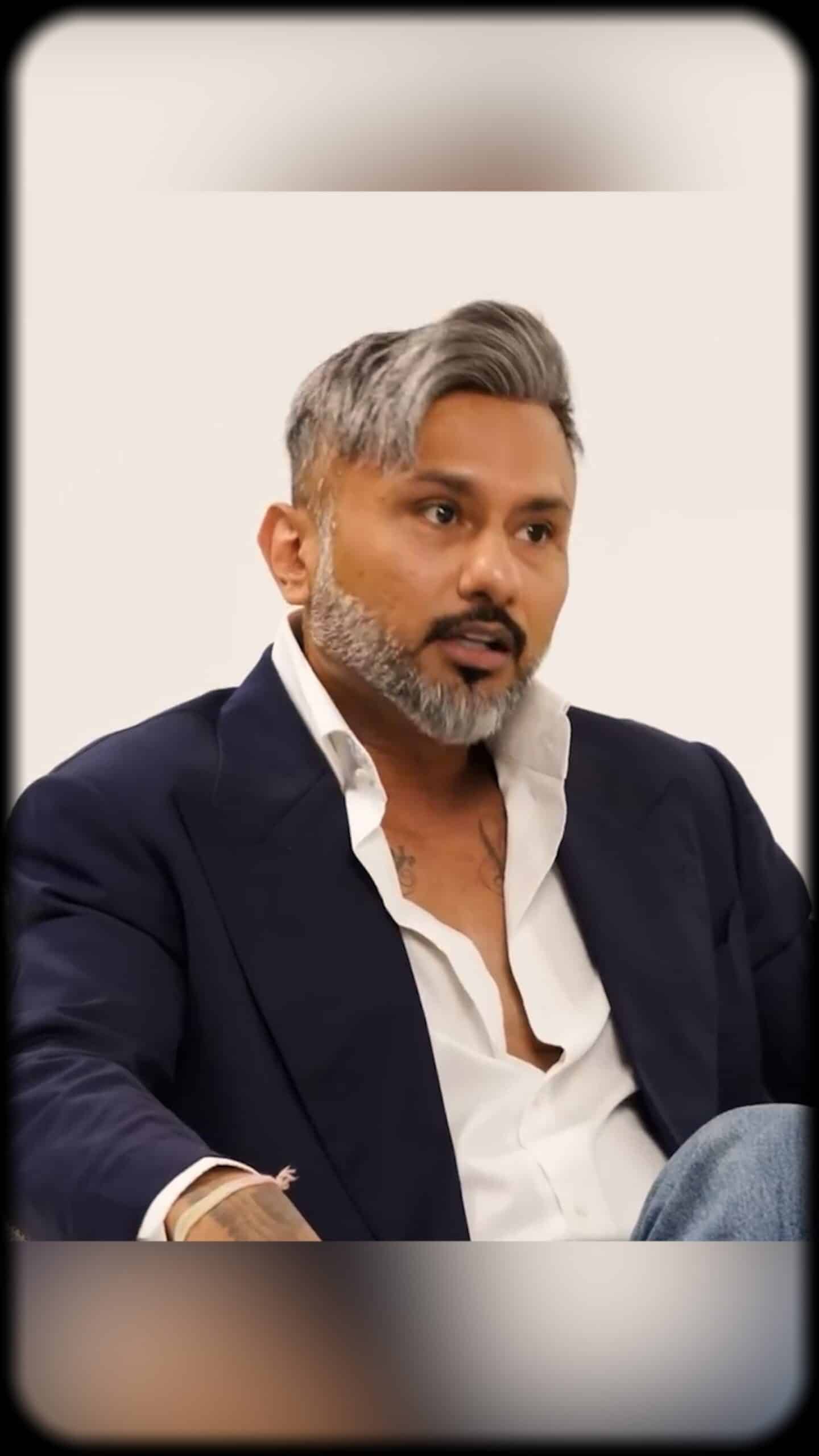 Honey Singh hair loss reveal — medication-induced baldness explained by Dr. Abhishek Pilani at Assure Clinic