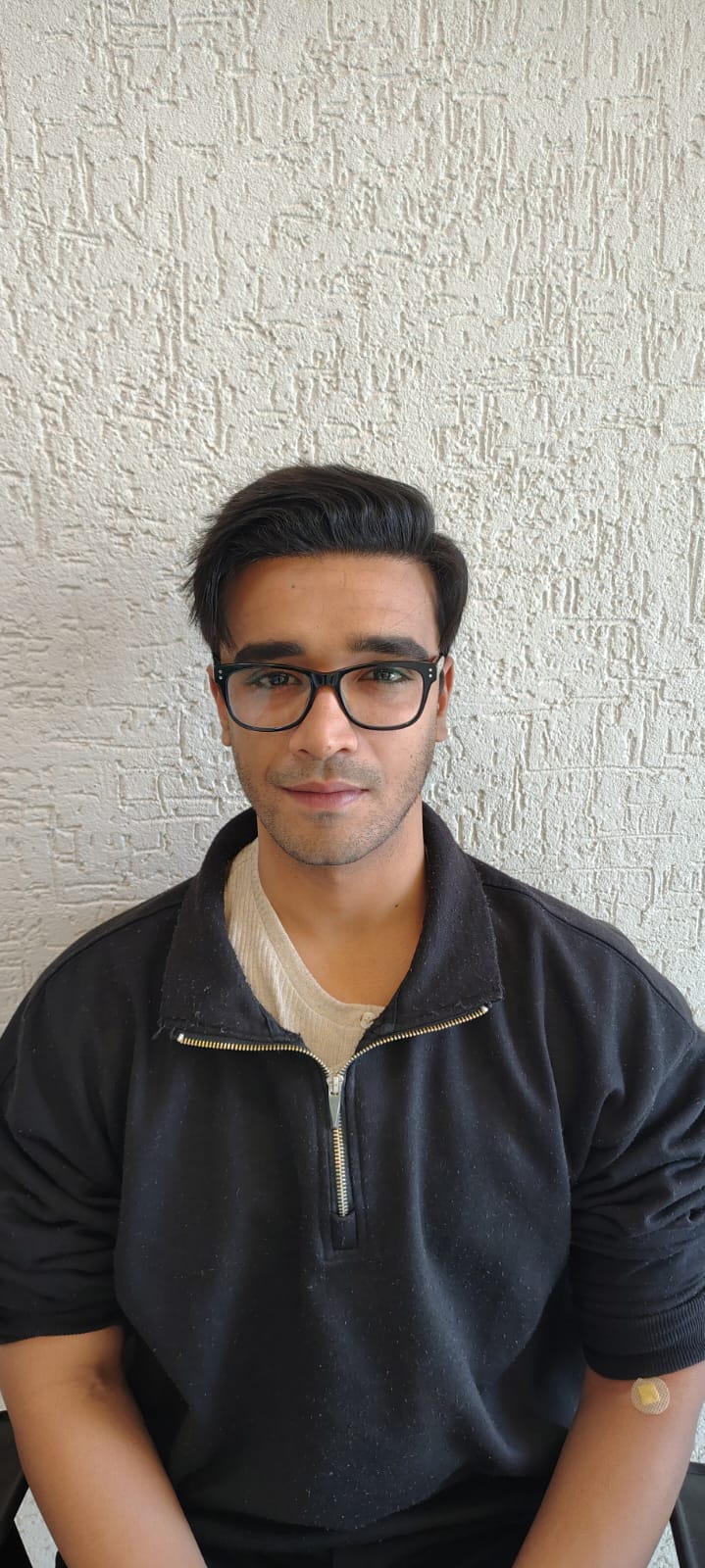 Miran Khan before hair transplant