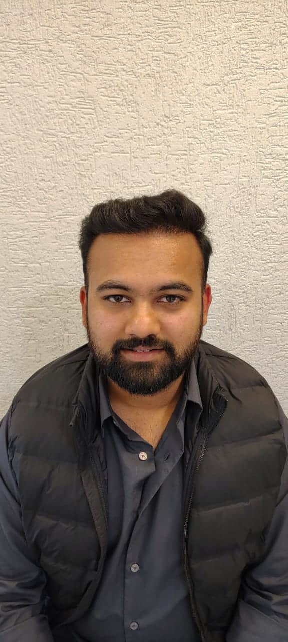 Chayan after hair transplant