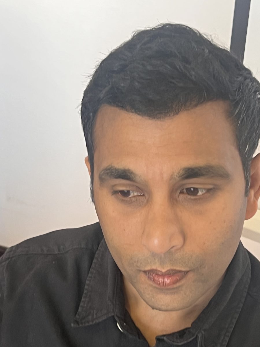 Hari Krishna — Eight Months — hair transplant at Assure Clinic