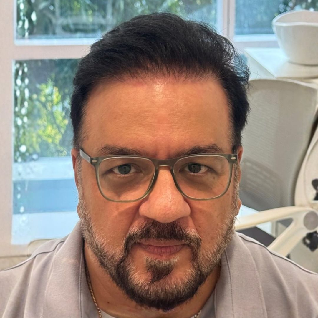 Praveen Changlani after hair transplant at Assure Clinic