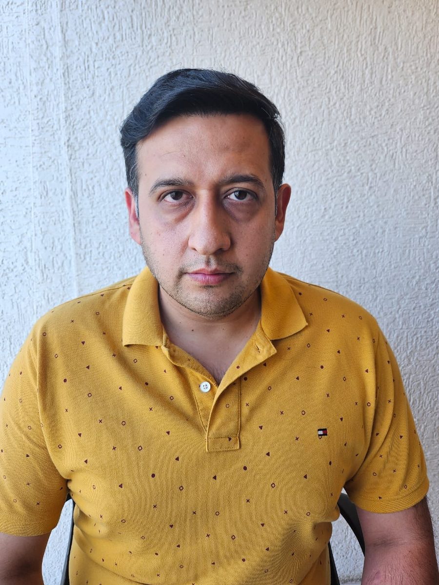 Rahul Jain — Eight Months — hair transplant at Assure Clinic
