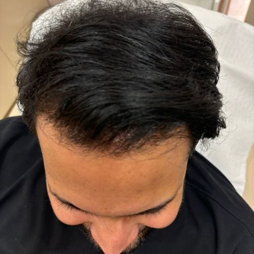 Roshan Shetty -12 months