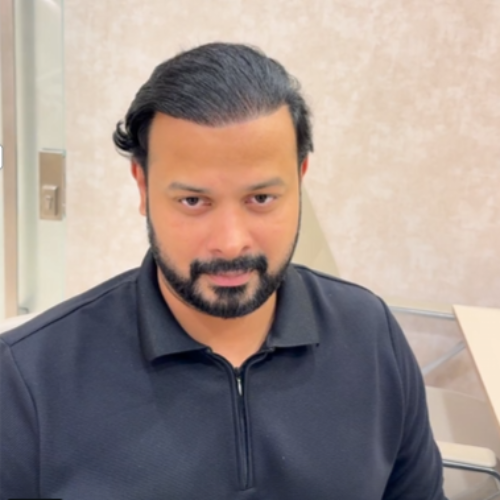 Jason Baby After Hair Transplant Surgery